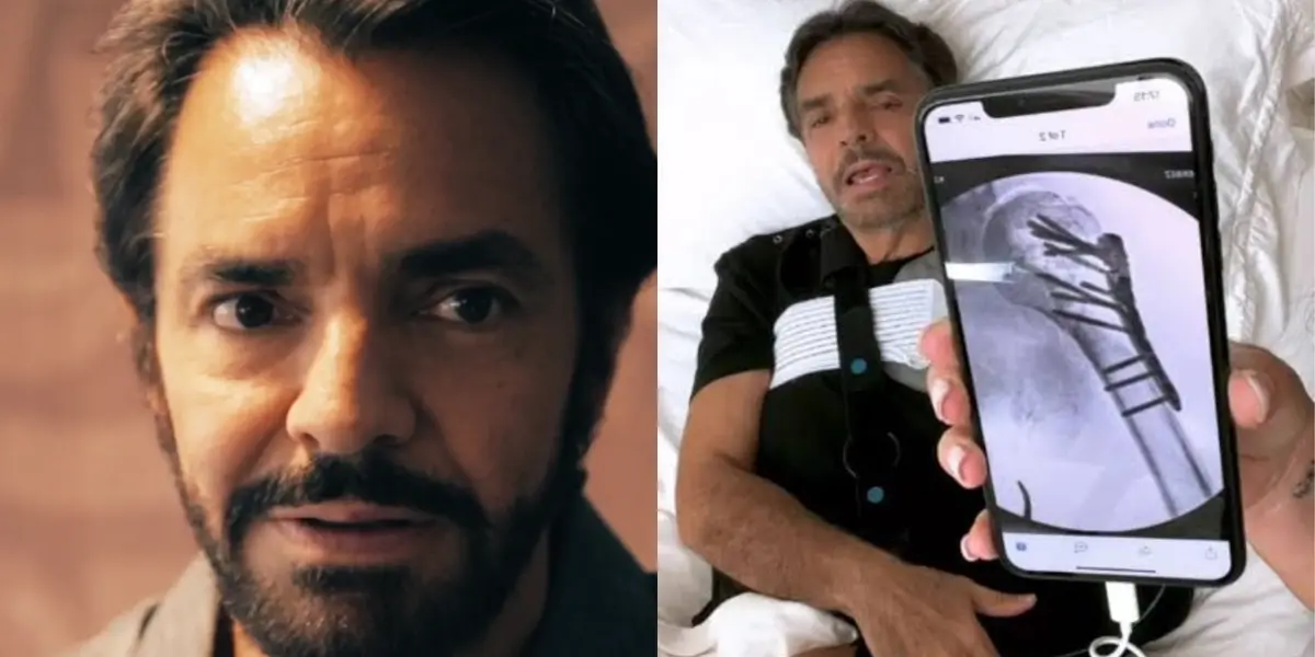 El actor mexicano se sinceró sobre el accidente de hace unos meses que casi lo lleva a perder hasta el brazo