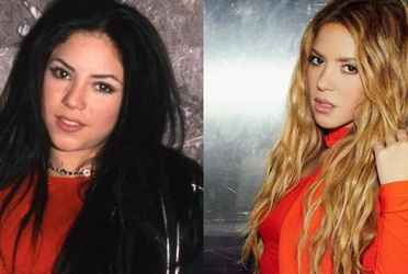 Shakira: Cuántas cirugías estéticas tiene